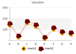 order genuine vasotec line